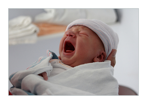 Baby Circumcision picture
