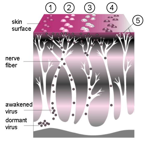 The Shingles Virus