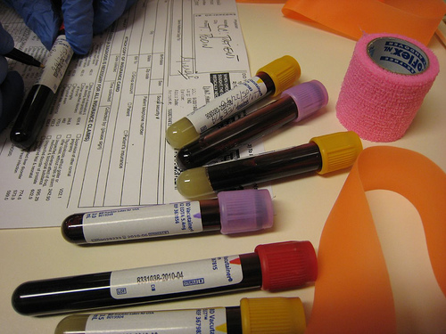 Blood tests can look for plasma porphyrins.