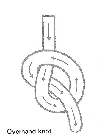 Figure 3 - Overhand Knot