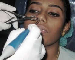 Undergoing Nasal Surgery