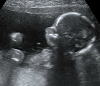 This is our "baby bean"