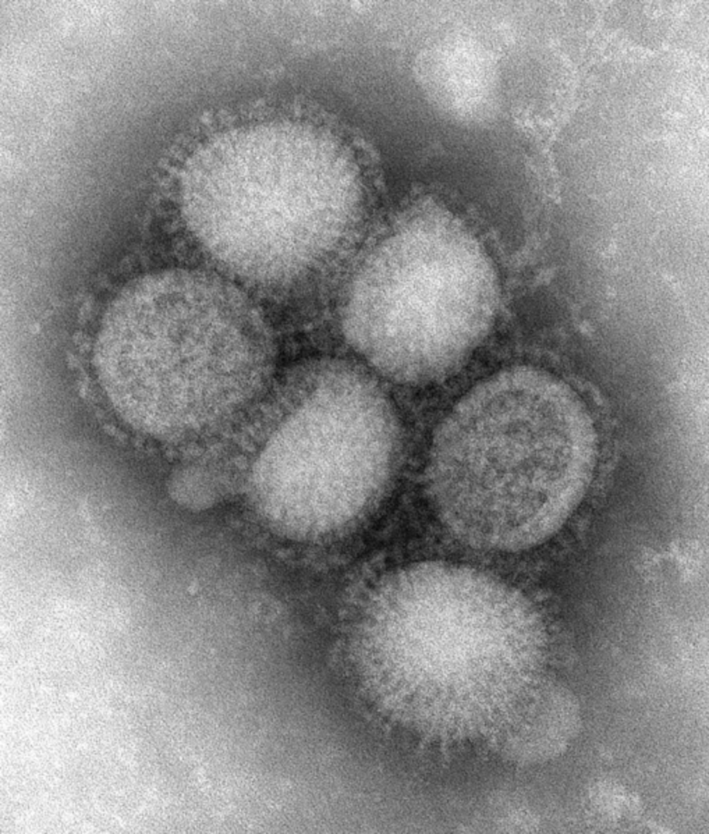 Microscopic image of the swine flu virus