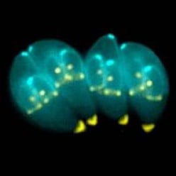 Toxoplasma gondii:  People Are Being Controlled by Tiny Parasites in Their Brains!