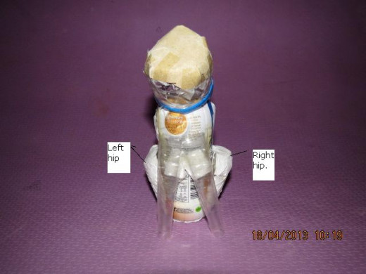 Fig 6:  Right and left hips.