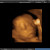 3-D Ultrasound at 21 weeks - Does not look like a blob of tissues