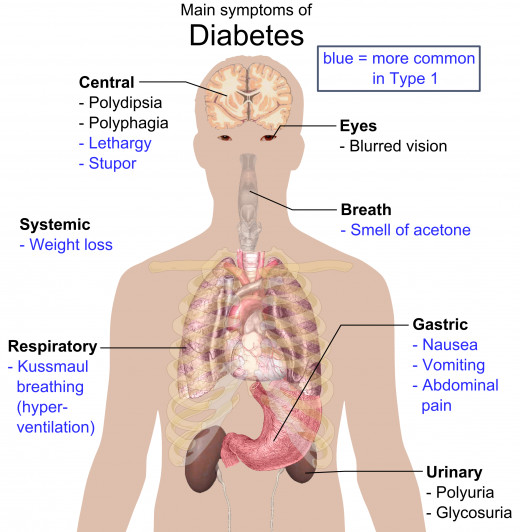 A picture showing the main symptoms of diabetes