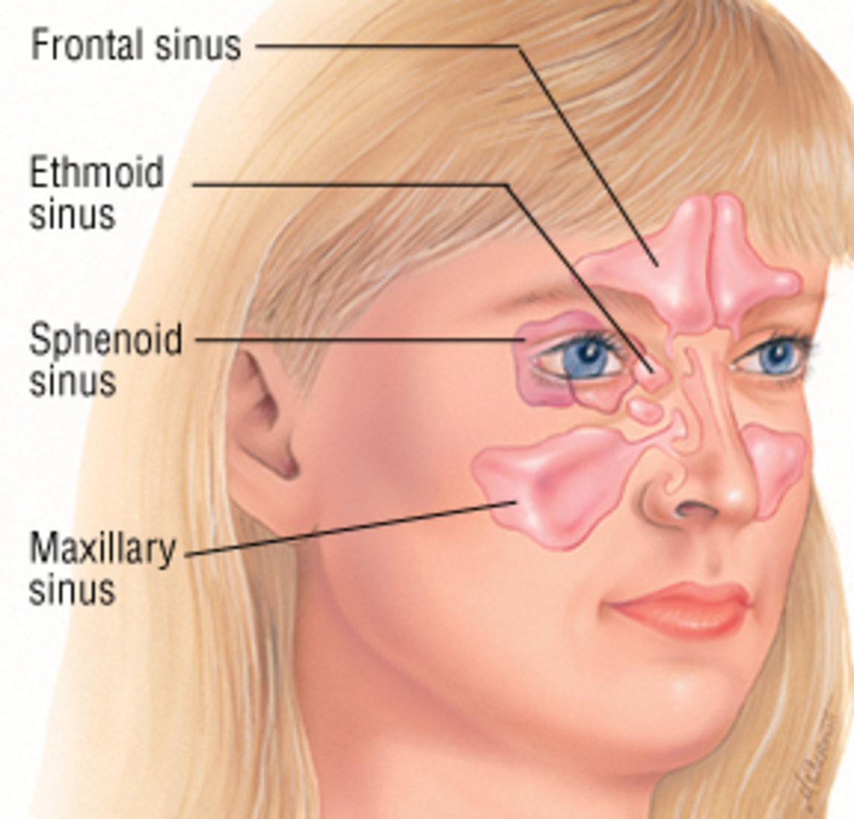 Sinus Headache Location Chart