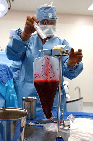The actual transplantation of bone marrow is much like a blood transfusion.