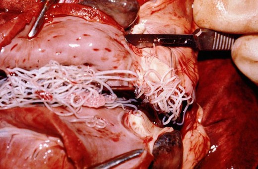 Dirofilaria immitis in canine heart