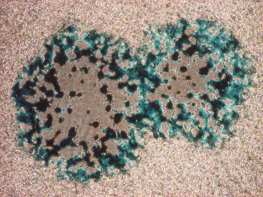 An oncolytic Vaccinia virus.