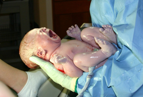 Just-born baby with umbilical chord still attached. Note the purple hue to the hands and feet, which will change to pink, once the babe has breathed enough oxygen. The water on his skin is from the amniotic sac he just left.
