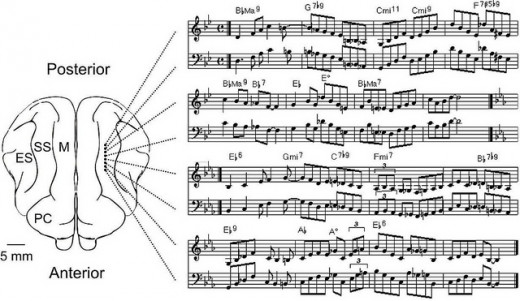 Musical brain