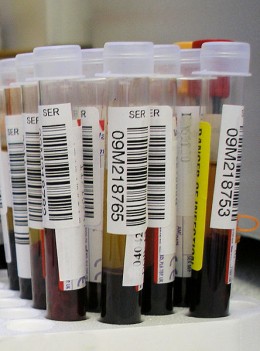 understanding blood test results pdf