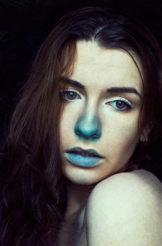 Congenital heart disease gives rise to central cyanosis due to mixing of arterial and venous blood within the heart or outside it