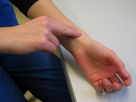 The radial artery is generally taken up for examining the pulse. The rate, rhythm, volume and character of the pulse and nature of the arterial wall are noted