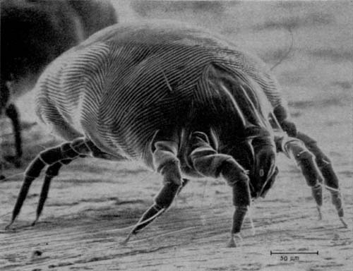 Dust Mites are icky enough - but it's the WASTE from them that can make it difficult for some of us Humans to breath.