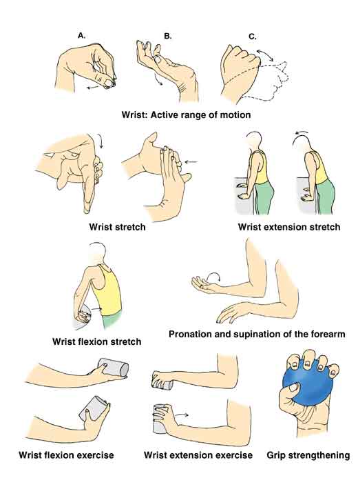 Wrist Fracture Dinner Fork Deformity at James Croy blog