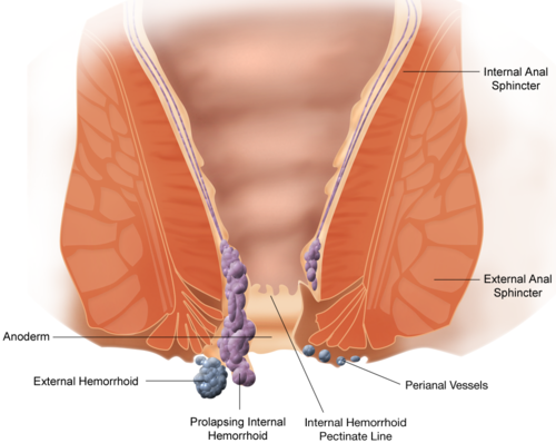Schematic Demonstrating the Anatomy of Piles
