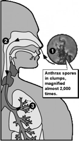Anthrax An Old Disease Or Possible Government Or