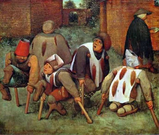 Another painting of victims of ergotism suffering from gangrene, by Pierre Bruegel .