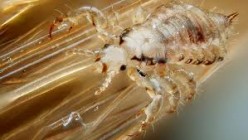 What causes Body Lice?