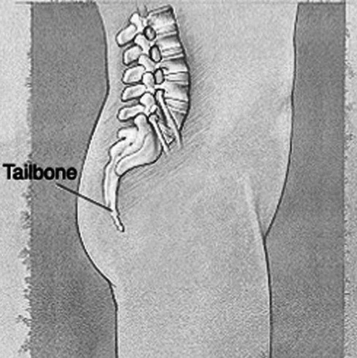 Bruised tailbone - Symptoms, Causes, Treatment, Healing time | HubPages