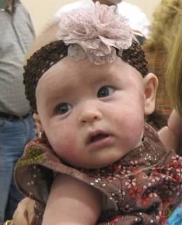 It may not be as obvious as it was in real life but you can see her cheeks are all red from the eczema. 