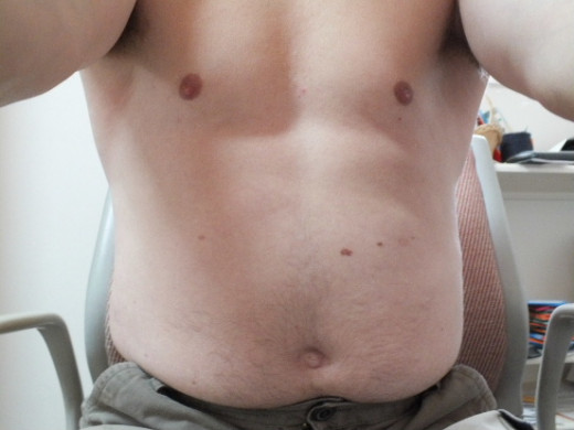 Before diet and exercise.