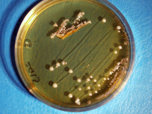 Good bacteria: Lactibacilli spp