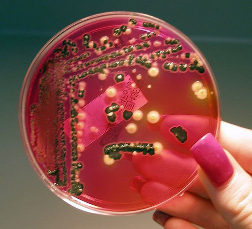 Bad bacteria: Salmonella in agar.