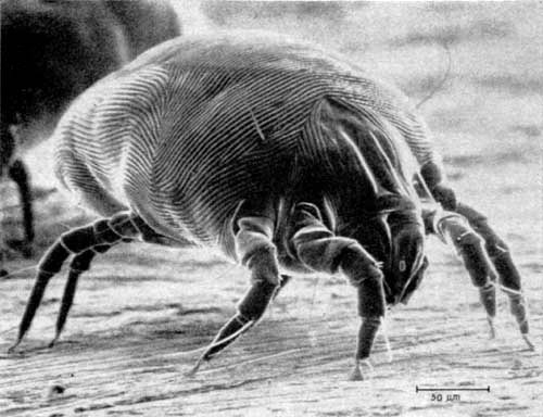 Good parasite: Dermatophagoides pteronyssinus (house dust mite)
