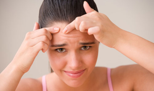 Popping zits is not your only weapon against acne.