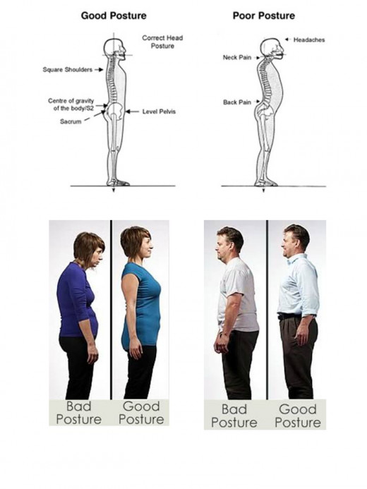 visual silhouettes of poor and good posture examples