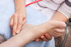 Neuropathy: A Simple Guide to the Nerve Disorder