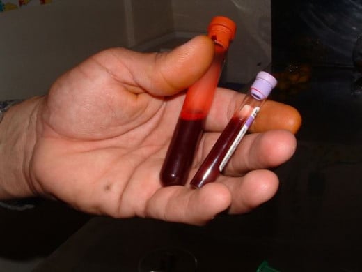 Blood test for testosterone levels is important as well as tests for other organ functions