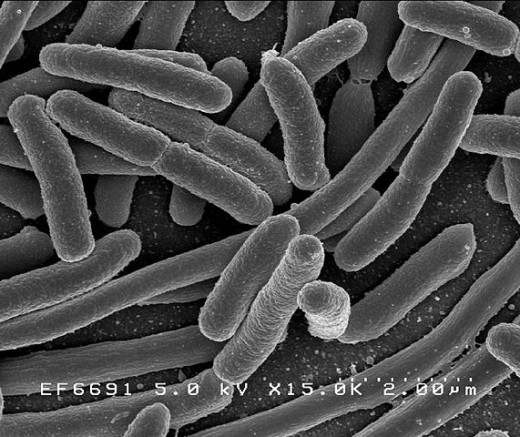 E. Coli bacteria shown magnified 15,000 times.