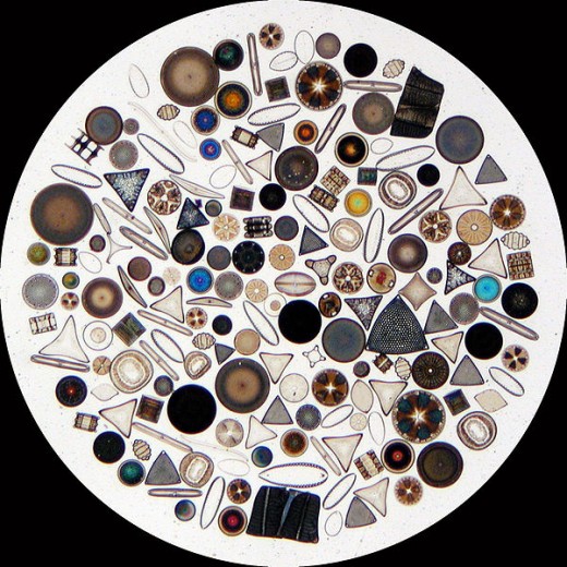 A variety of marine diatoms on a microscope slide. Even though these are tiny, they're a very important part of the food chain.