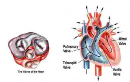 Chronic Valvular Heart Disease: Mitral Stenosis (MS)