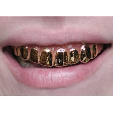 Gold caps on teeth are popular 