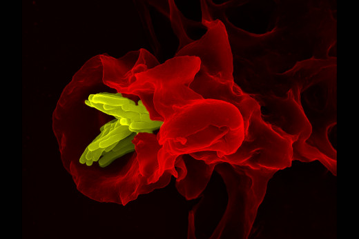 A macrophage (red) engulfs a tuberculosis myobacterium (yellow)
