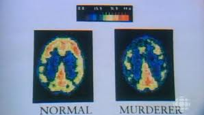 Criminal and Normal brain patterns