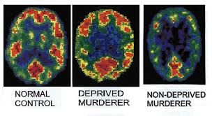 Brain patterns - criminology