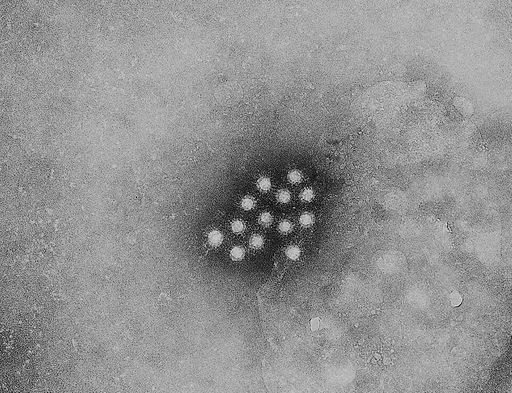 The Hepatitis A Virus