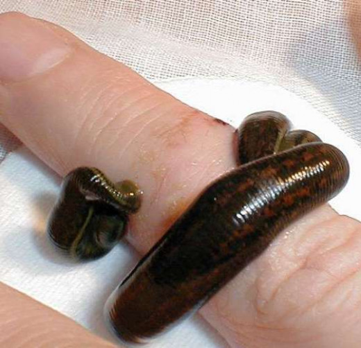 Blood sucking leech on a finger