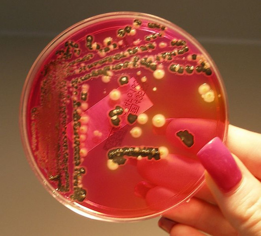 Salmonella bacteria growing on XLD agar
