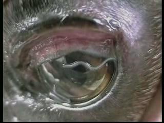 Helminthiasis is diagnosed in the vast majority of instances by the demonstration of the adults, larvae or eggs in appropriate specimens. Indirect methods include immunological test like skin tests and complement fixation tests or more specific tests