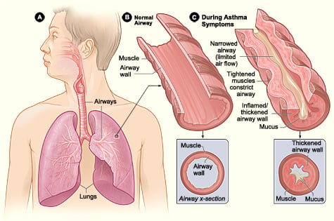 Use herbs for asthma symptoms
