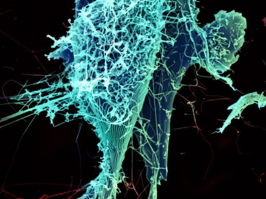 An electron micrograph of string-like Ebola virus particles shedding from an infected cell