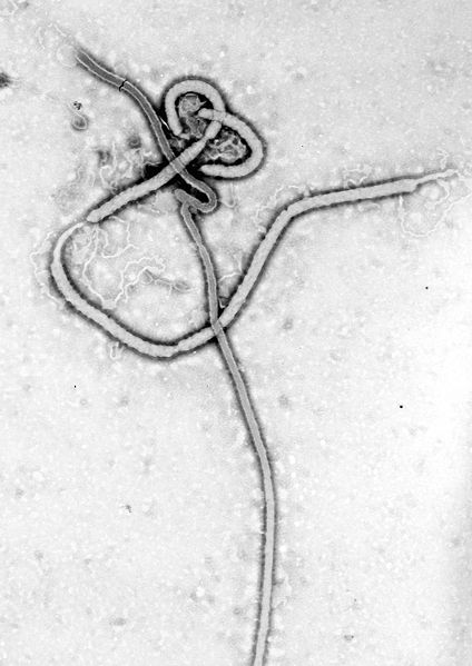 Transmission Electron Micrograph of the Ebola Virus